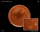 clostridium sordellii